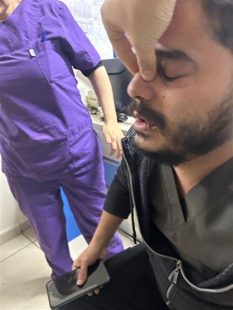 Gaziantep’te hasta yakınları tarafından darp edilen doktorun burnu kırıldı